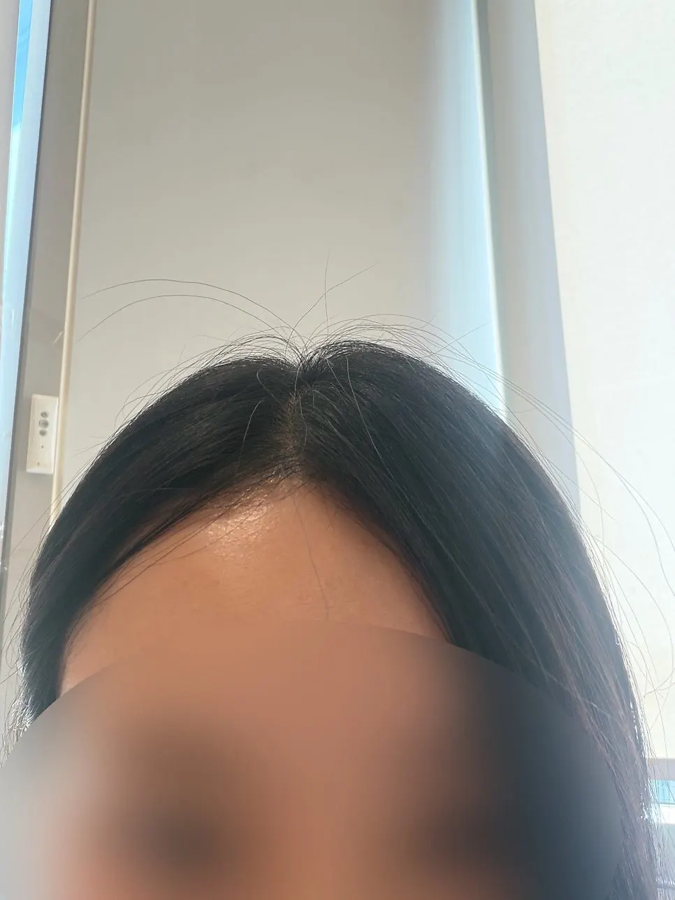 앞머리매직 시술 전 뻗친 앞머리