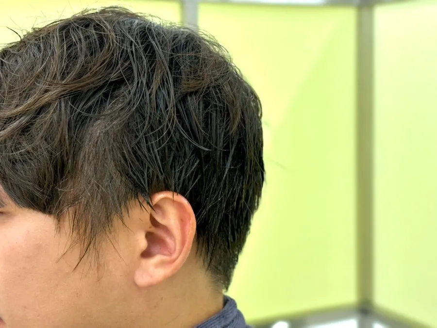 두피 보호제를 도포하는 시술