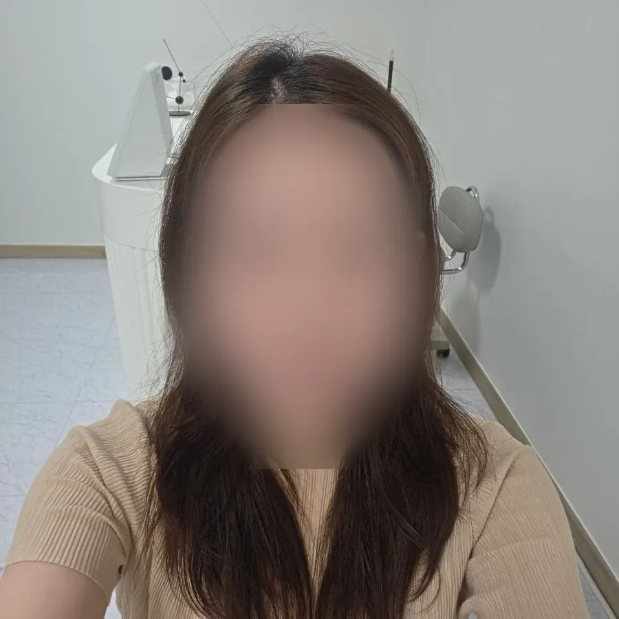 Sparse eyebrow condition before the procedure