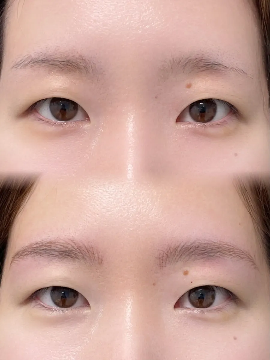 Front view of textured brows right after the procedure