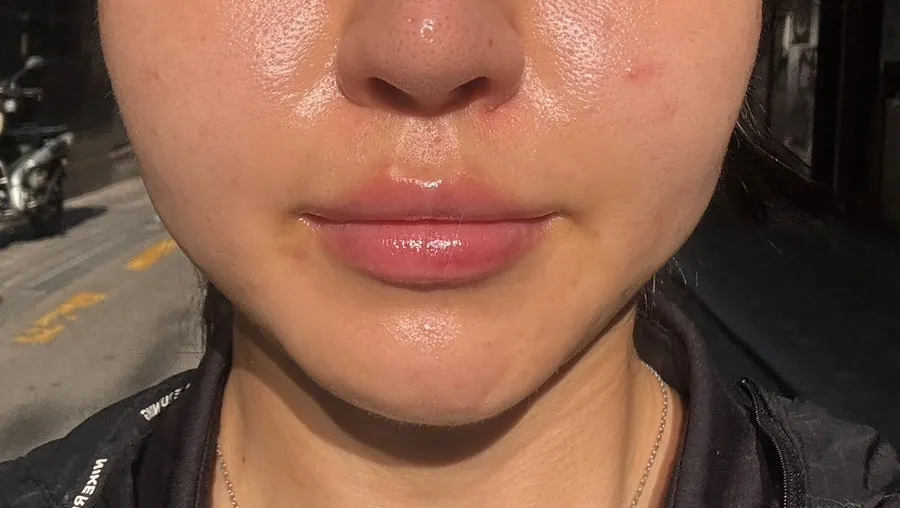 Discussing facial redness and heat concerns