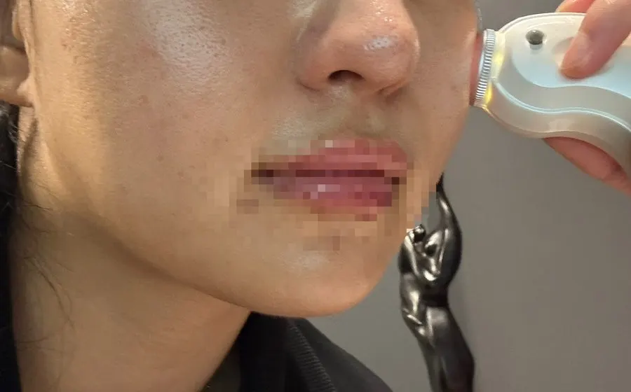 Skin-diagnosis device scan at Stern Clinic