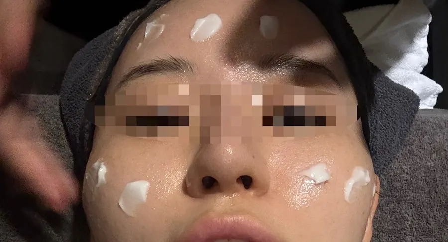 Cleanser and cream samples used during the treatment