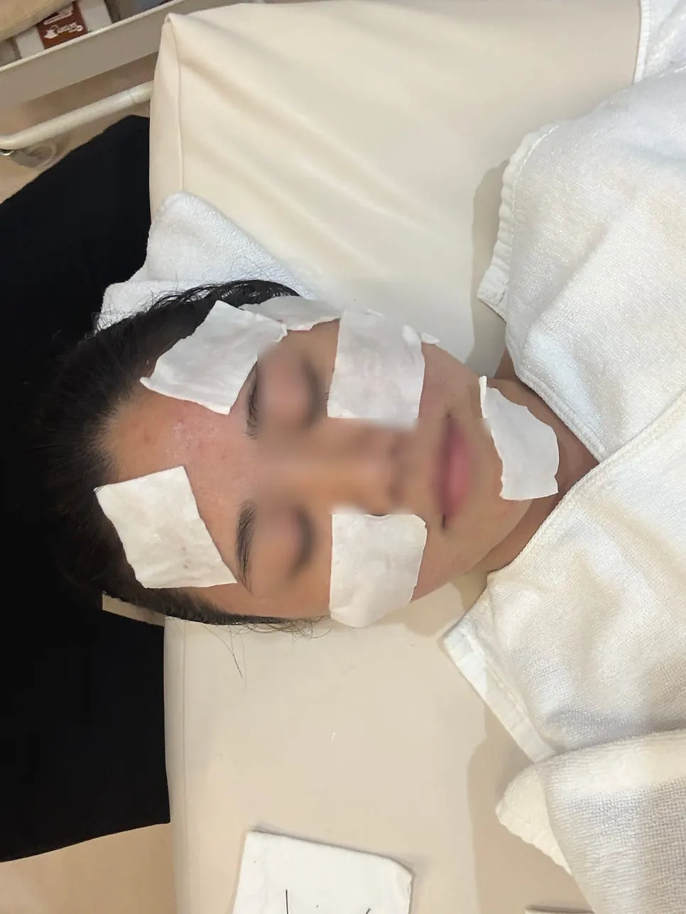 Extraction care underway for bumpy acne