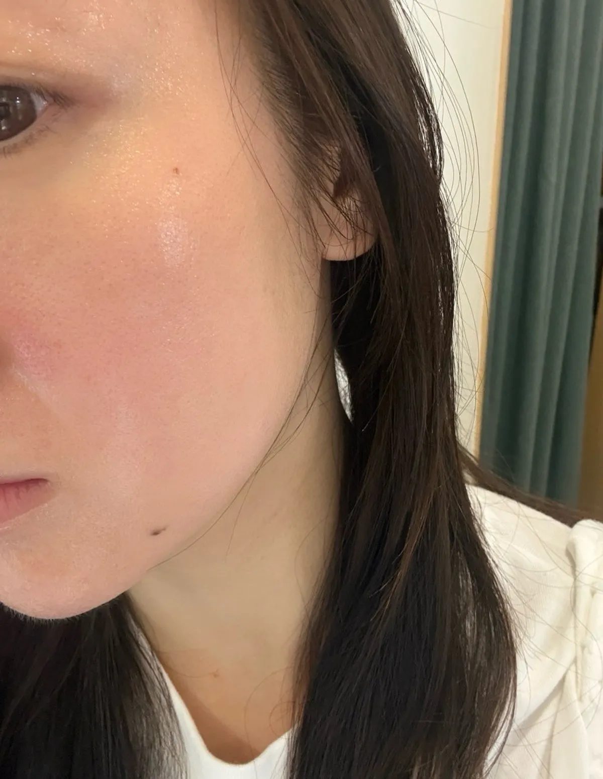 Main image of the aquapeel treatment at Esthetic Healingsu