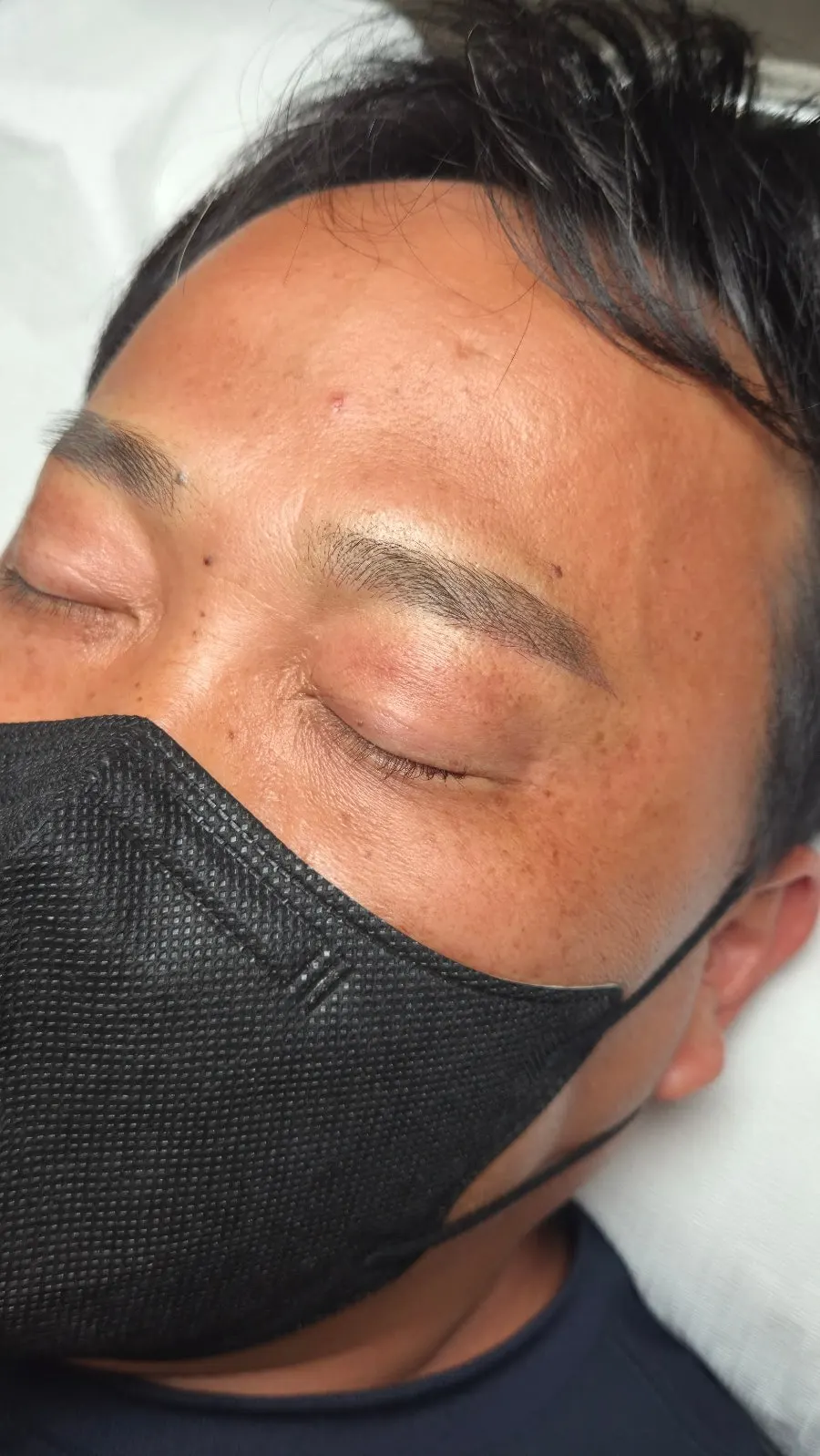 Eyebrows wiped down after the procedure
