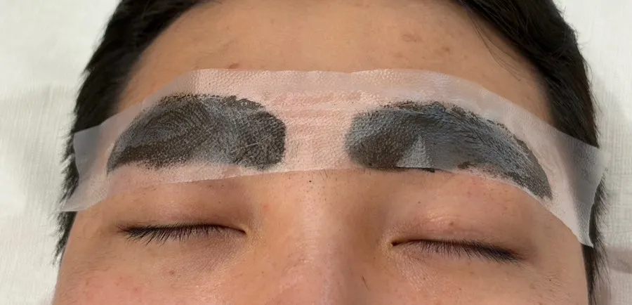 Color difference between both eyebrows right after the procedure