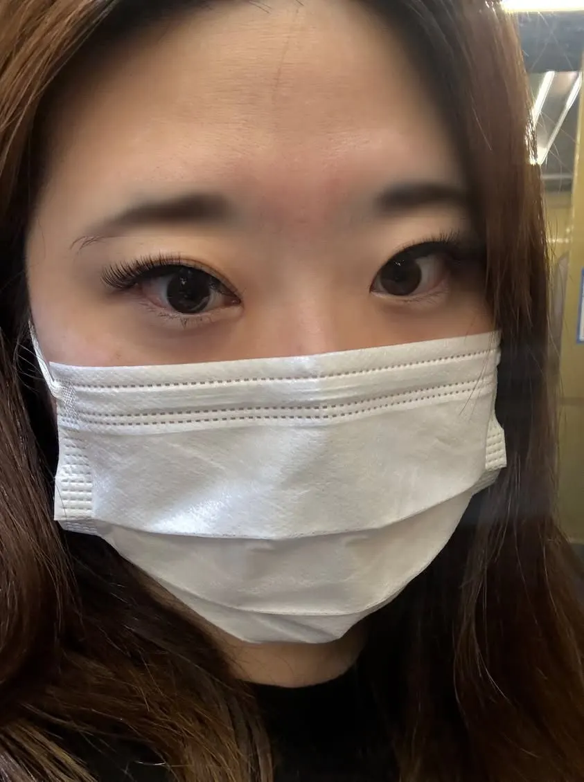 Eyes after 13–14 mm volume lash extensions