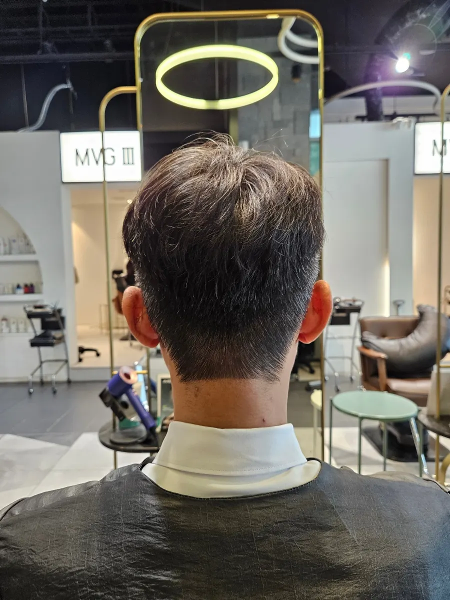Scalp condition seen in the scalp diagnosis