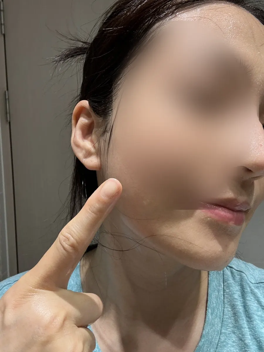水分を残した肌にパックを密着させる方法