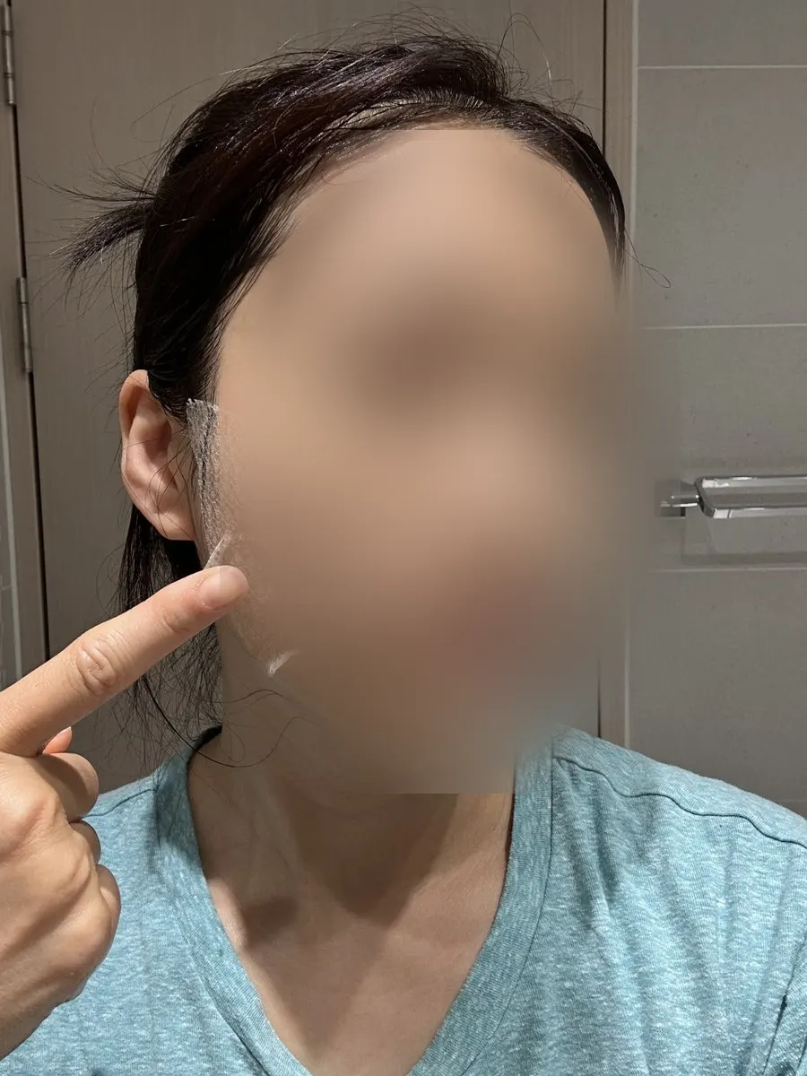 乾燥したマスクパックを剥がす使用ステップ