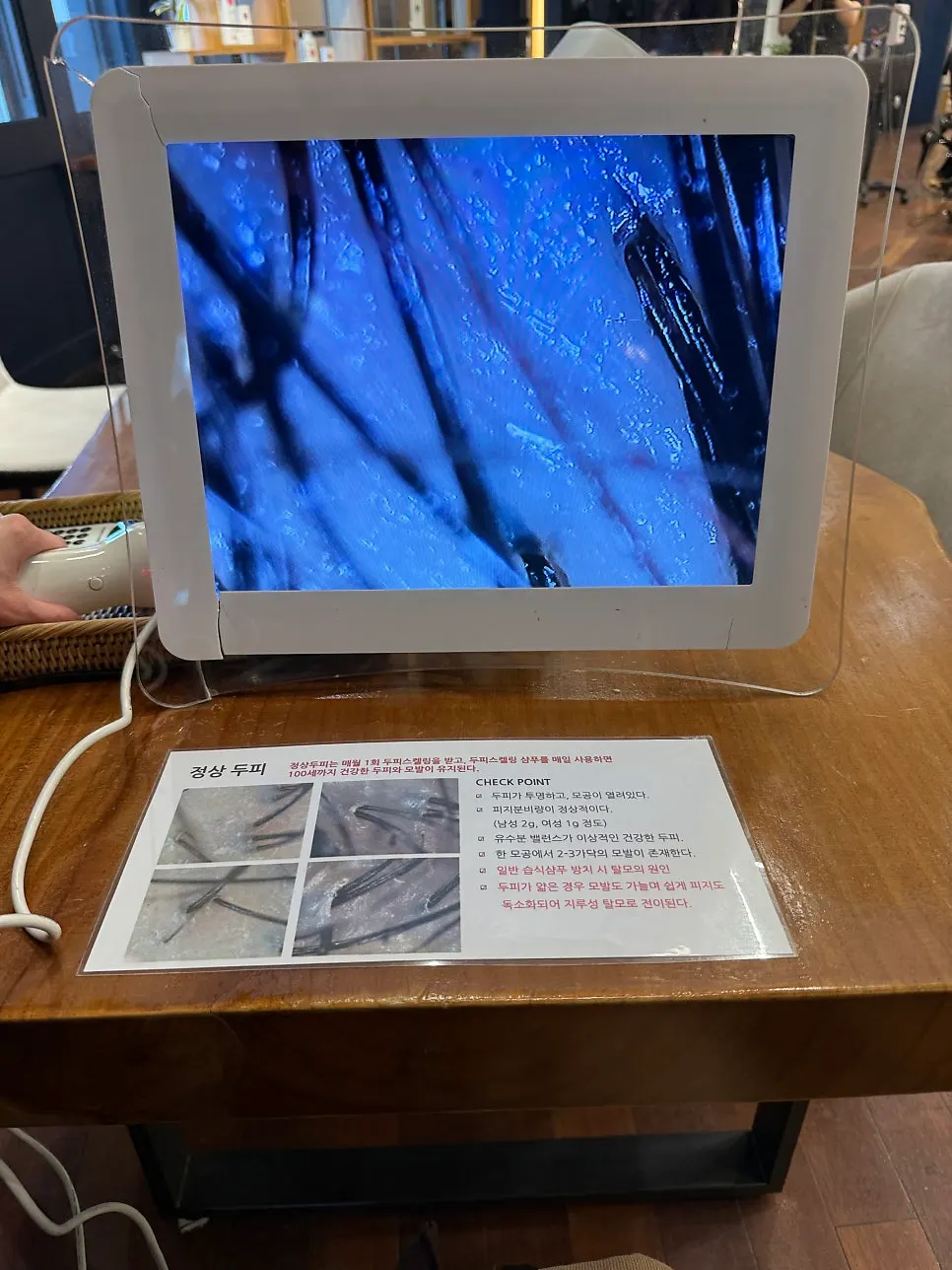 두피 상태를 비교 분석해주는 화면