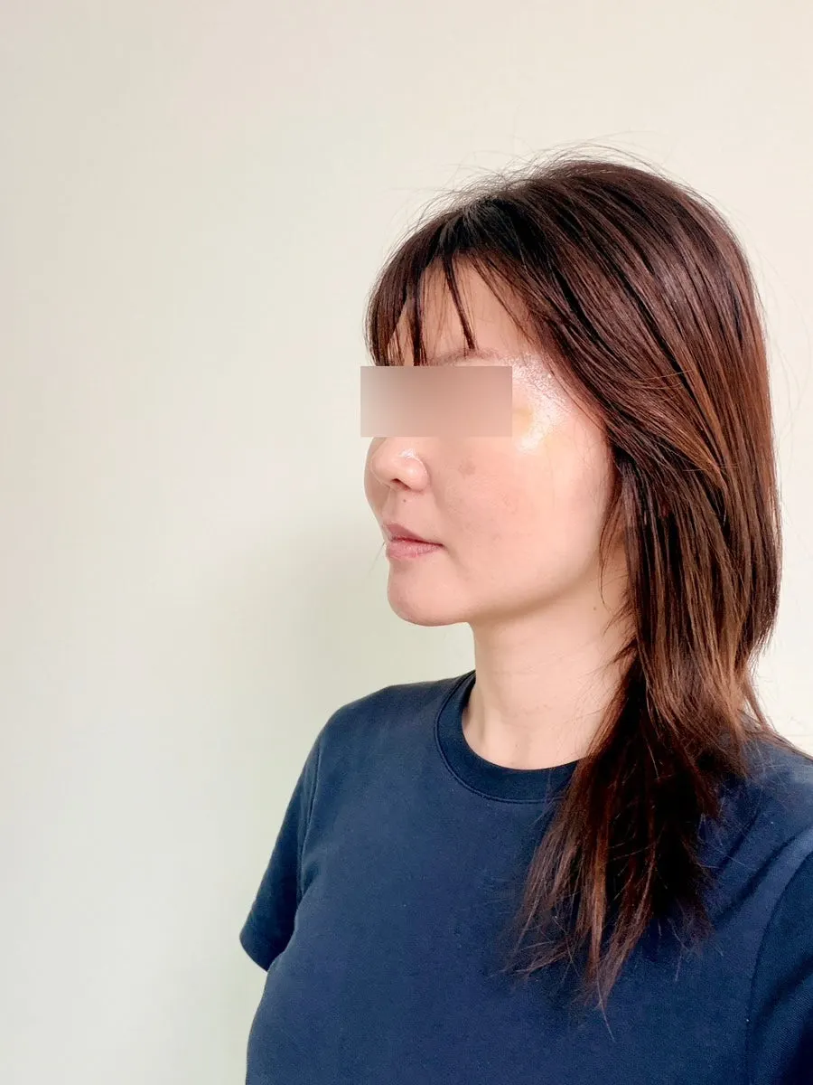 보그헤어 창원시티세븐점 시술 자리