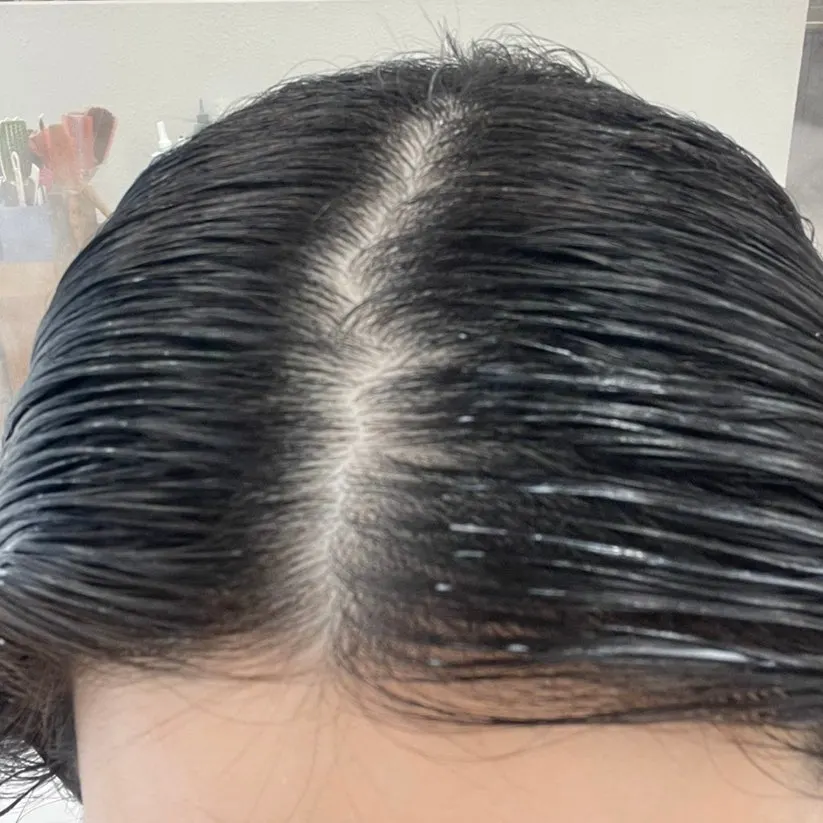 꼼꼼하게 진행 중인 모발 클리닉