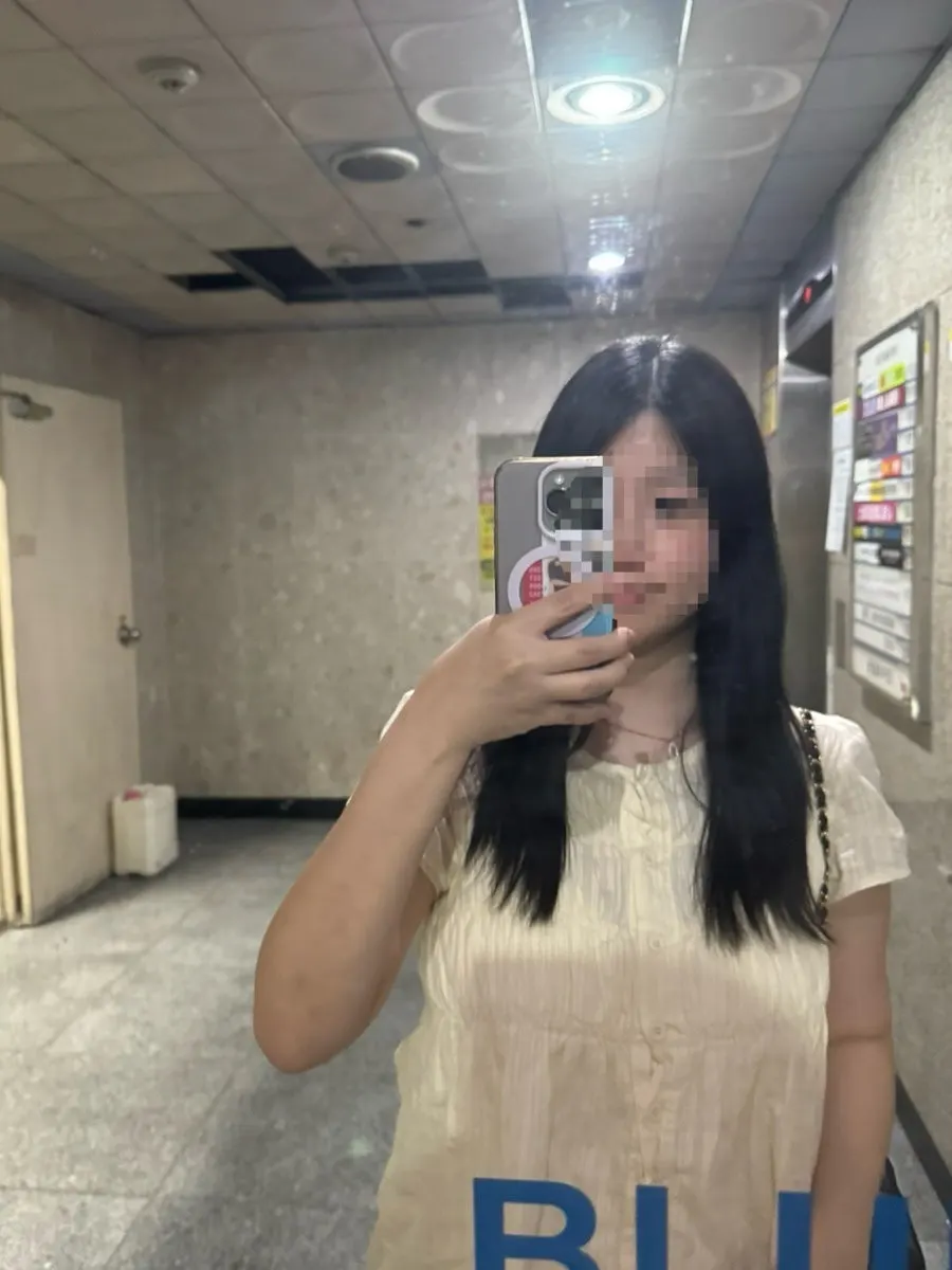 Mid-to-long hair length before the treatment