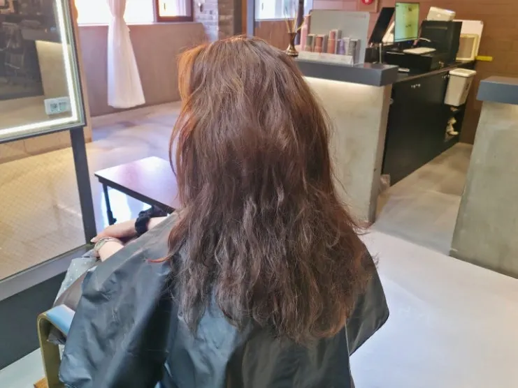 Side view before treatment showing misplaced layers