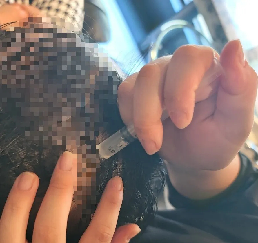 Scalp ampoule applied with a syringe-shaped applicator