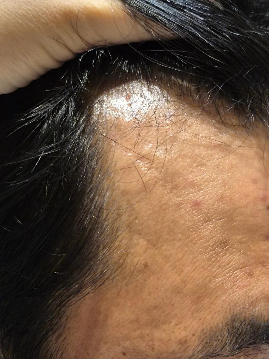 Scalp-condition check