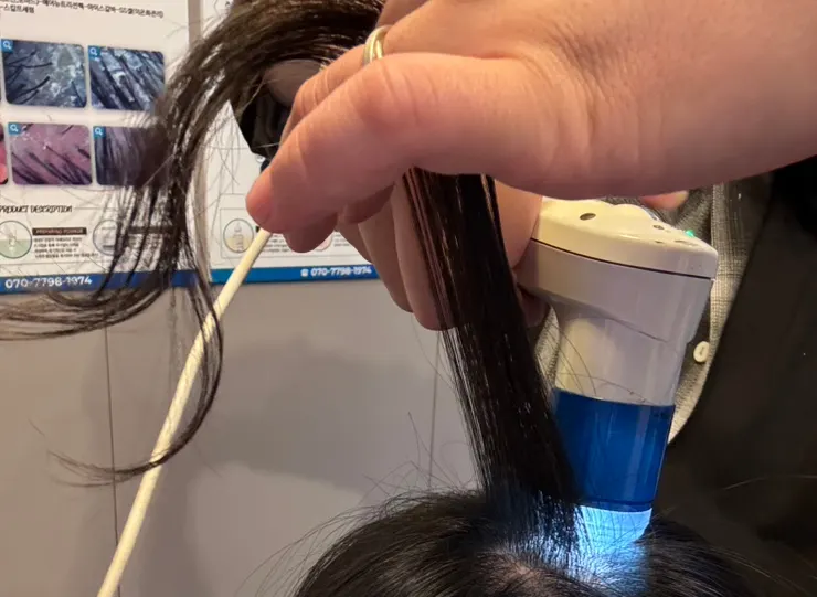 Inside the consultation room where scalp measurement takes place