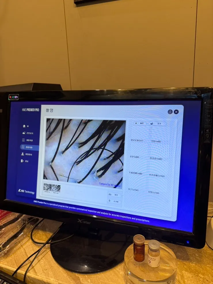 Checking the condition of the crown scalp