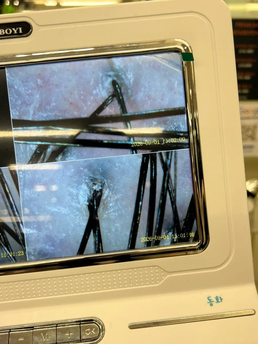Scalp pore diagnosis screen before scaling