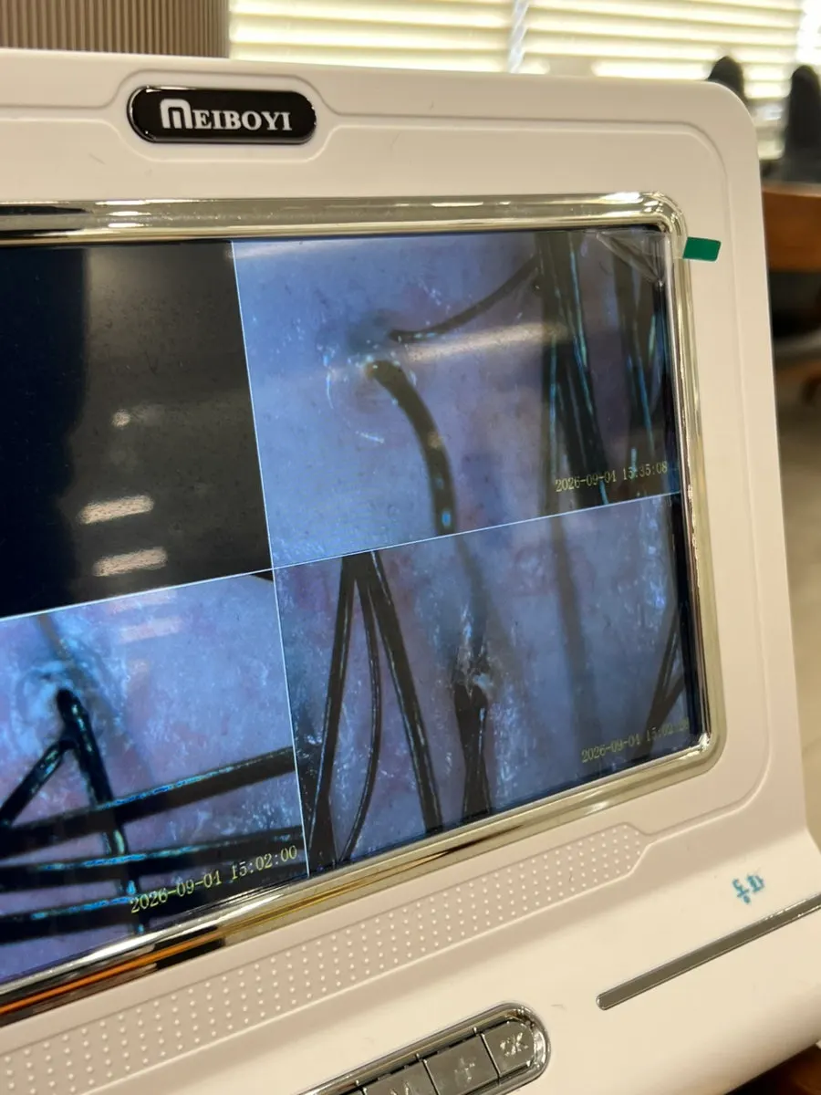 Diagnostic screen showing cleared scalp buildup