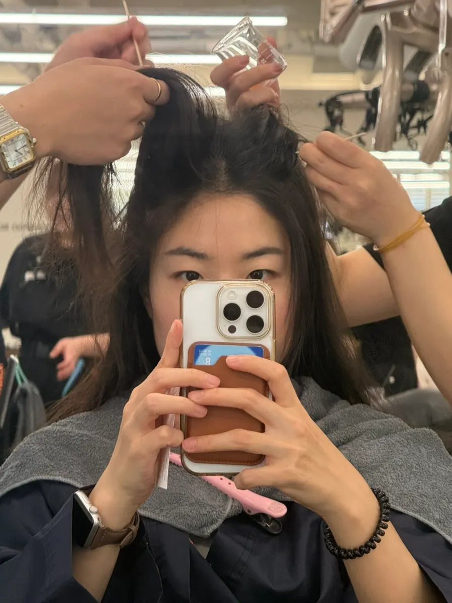 Before the scalp care began