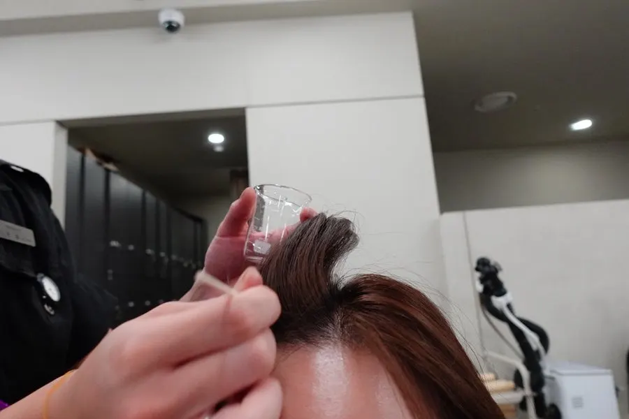 두피 전용 진단 카메라로 두피 상태 측정