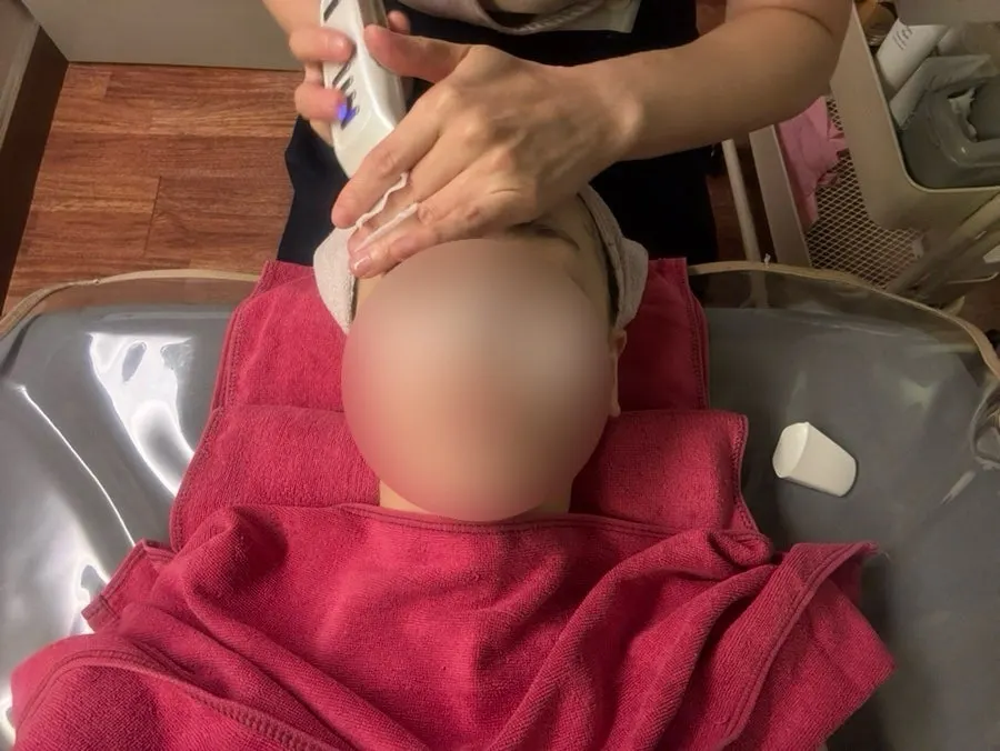 기계로 불린 각질과 피지를 제거하는 모습