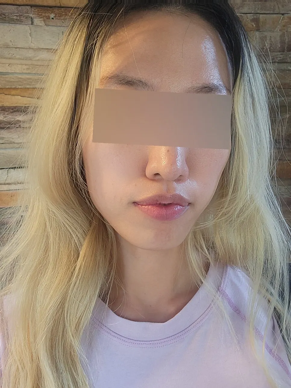 Face with refined, even tone right after treatment