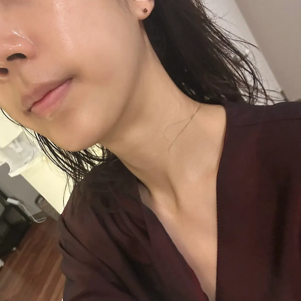 Skin the day after the pre-wedding treatment