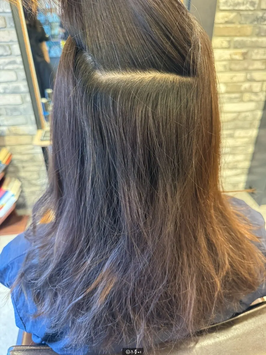Inner roots bent to one side before treatment