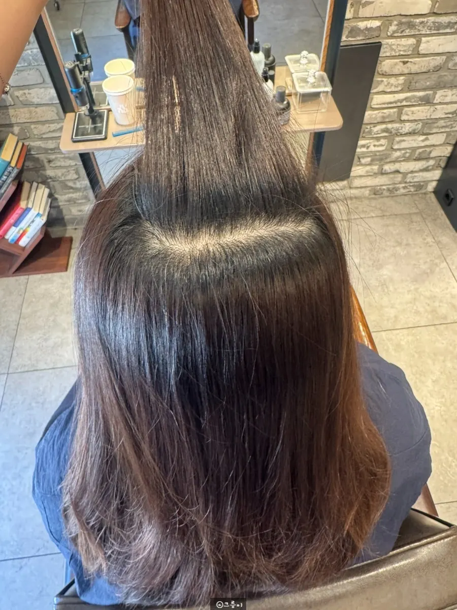 Roots now pulled straight down after treatment