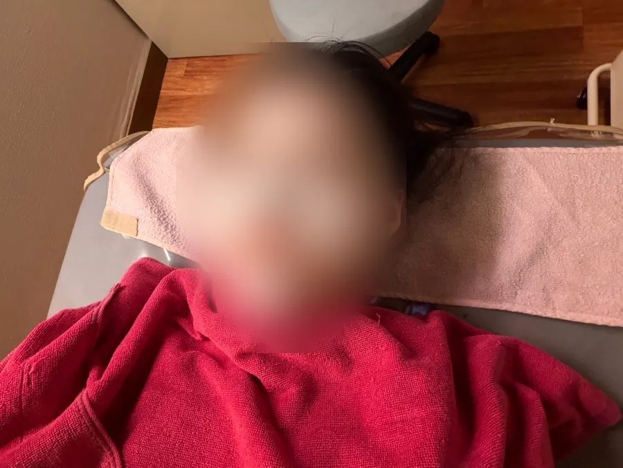 Lying on the treatment bed while sebum softens