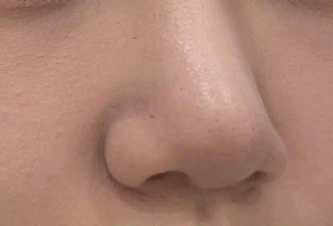 피지와 각질 고민을 설명하는 이미지