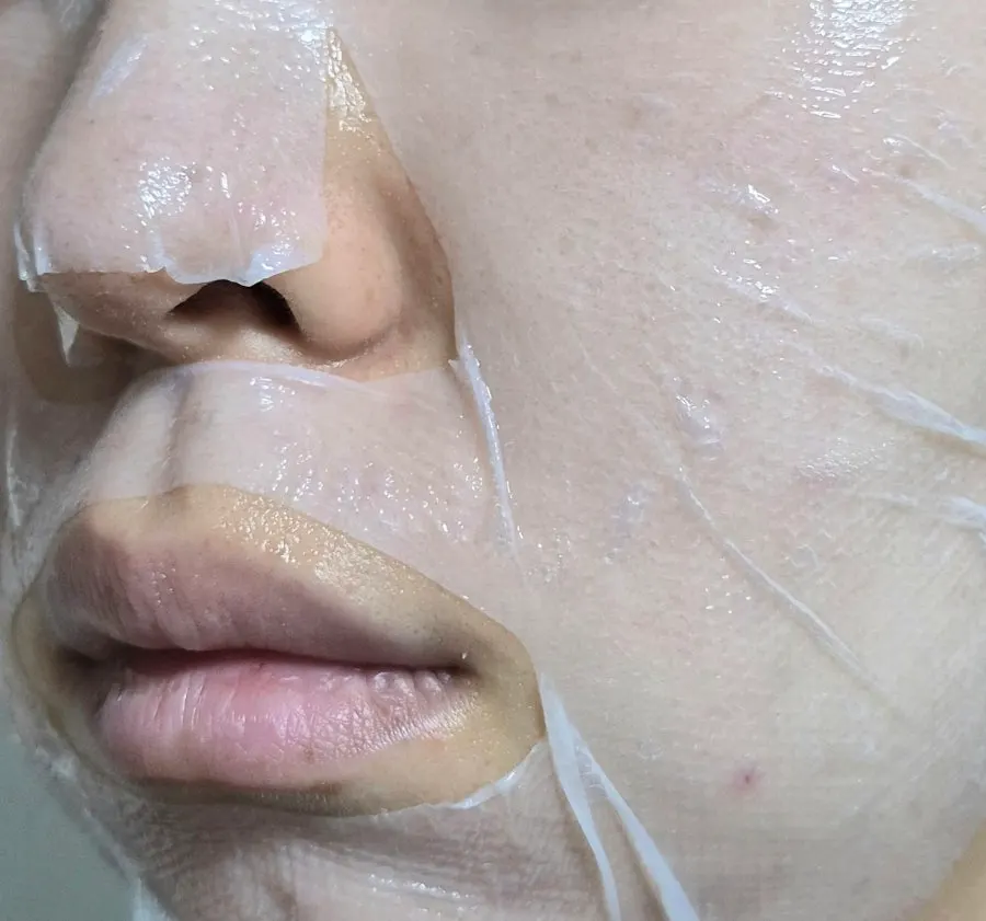 패치를 붙이고 1시간 기다리는 홈케어 장면