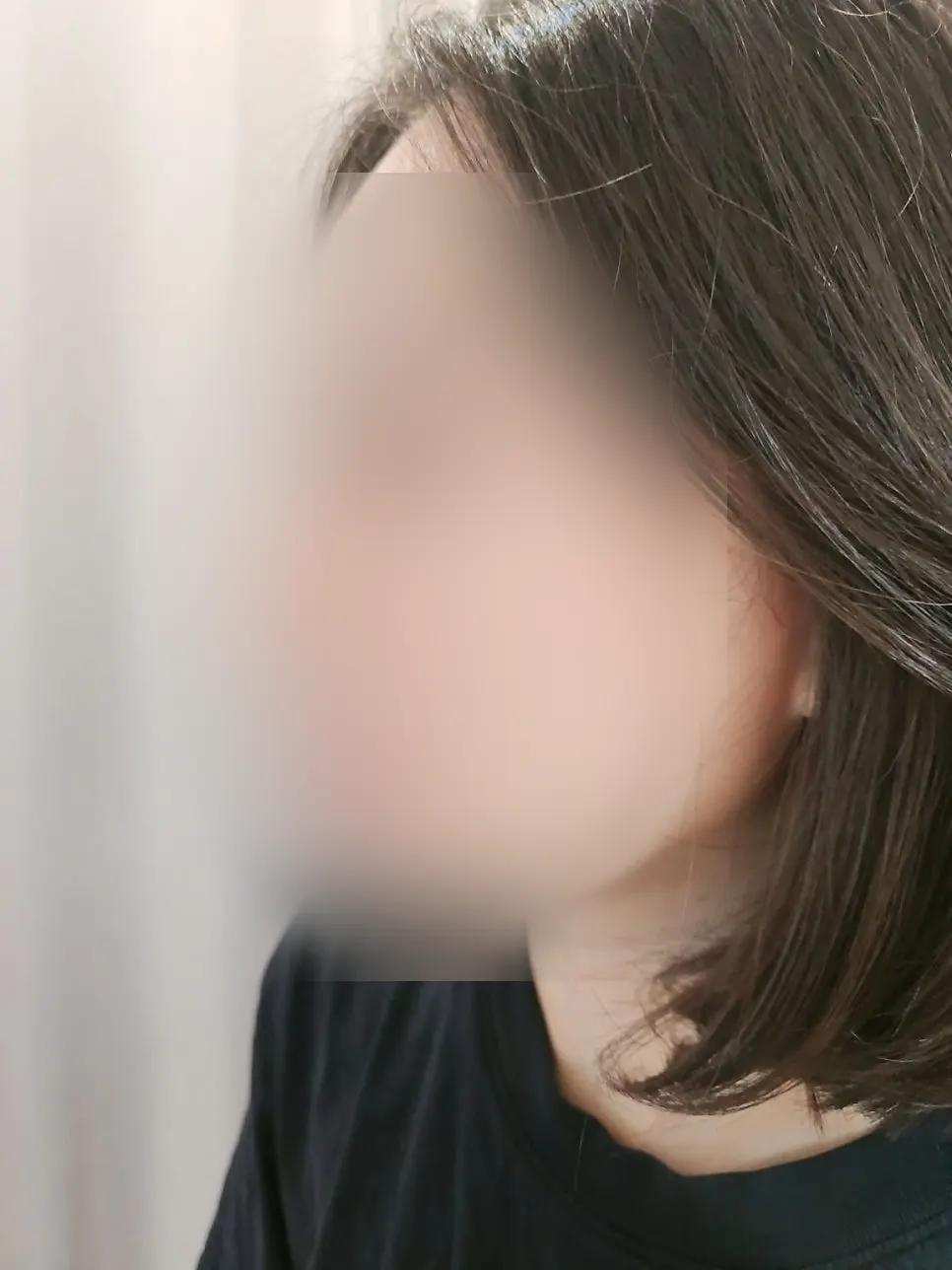 Refined skin after rinsing with water post-patch