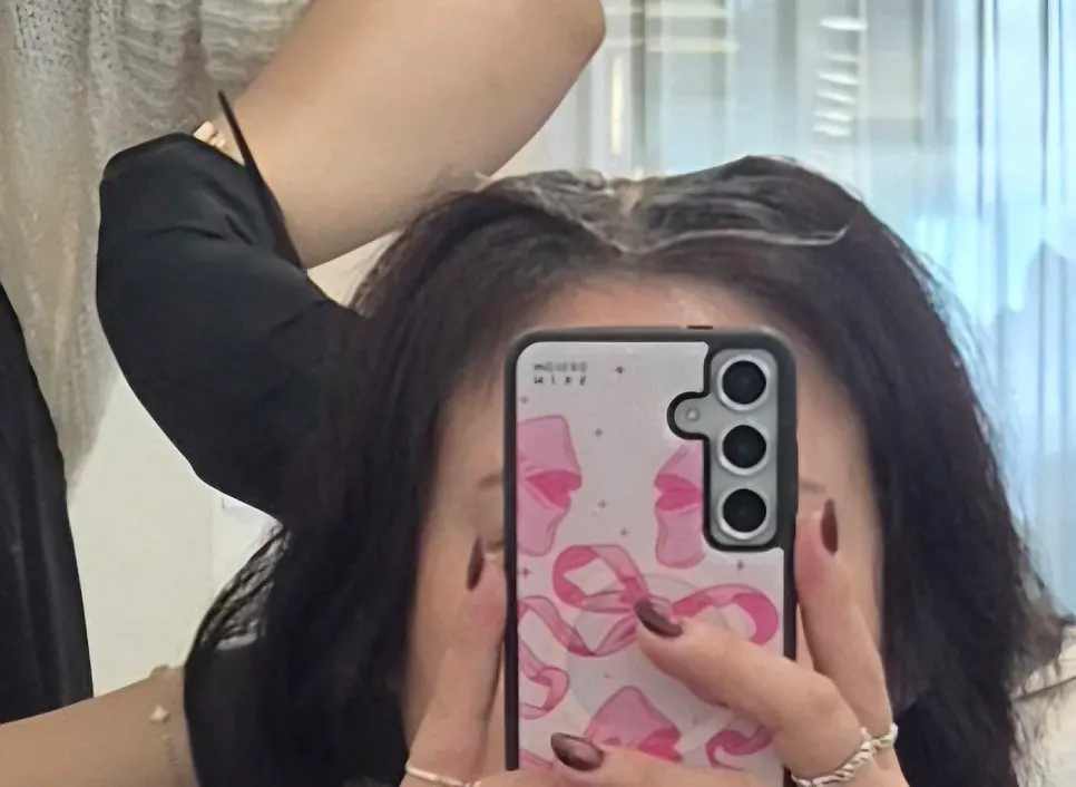 Checking the condition of a sensitive scalp