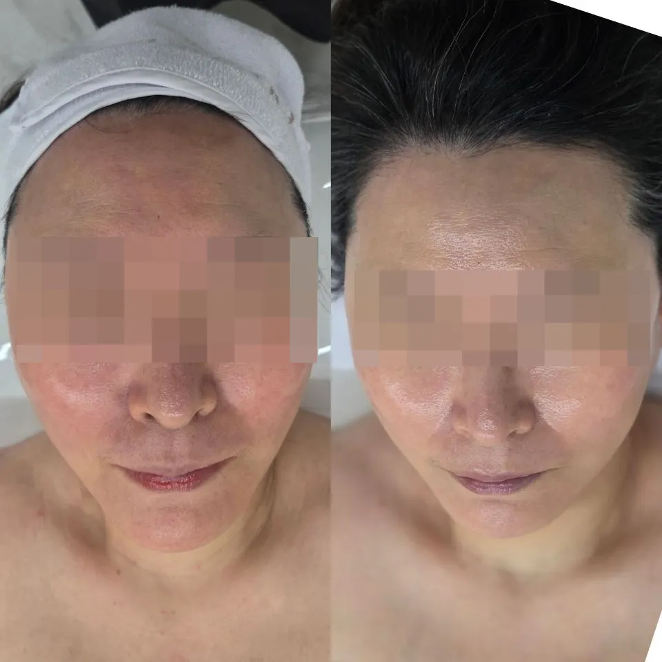 Brighter skin texture immediately after Water Glow Detox Care