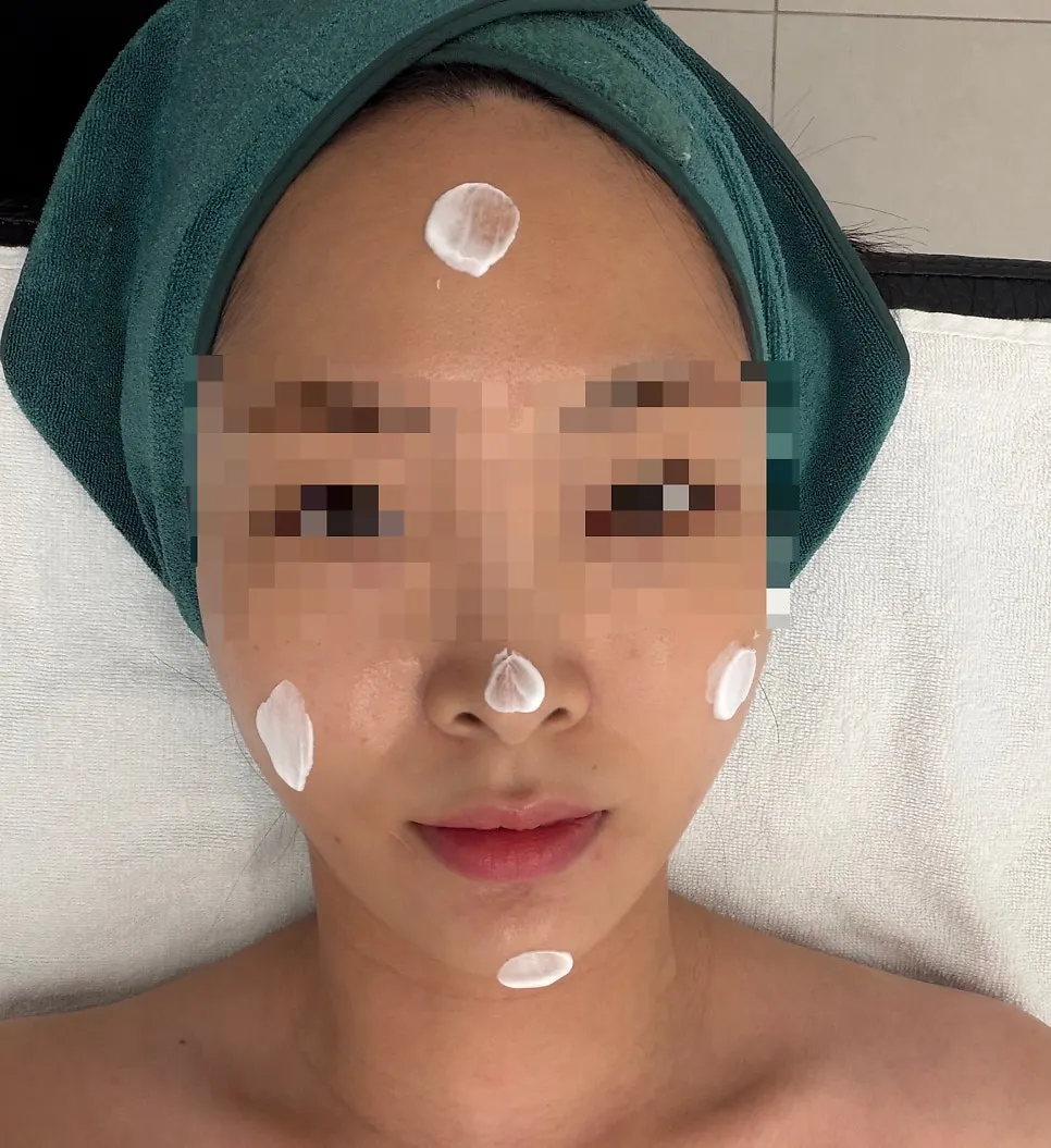 HIFU treatment process for facial-contour areas
