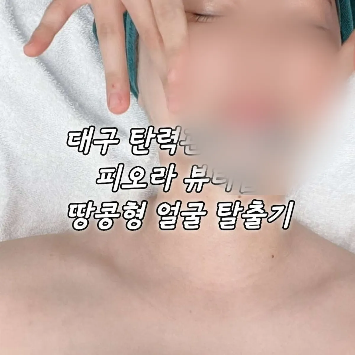 Introduction image for Fiora Beauty Shop's skin elasticity care