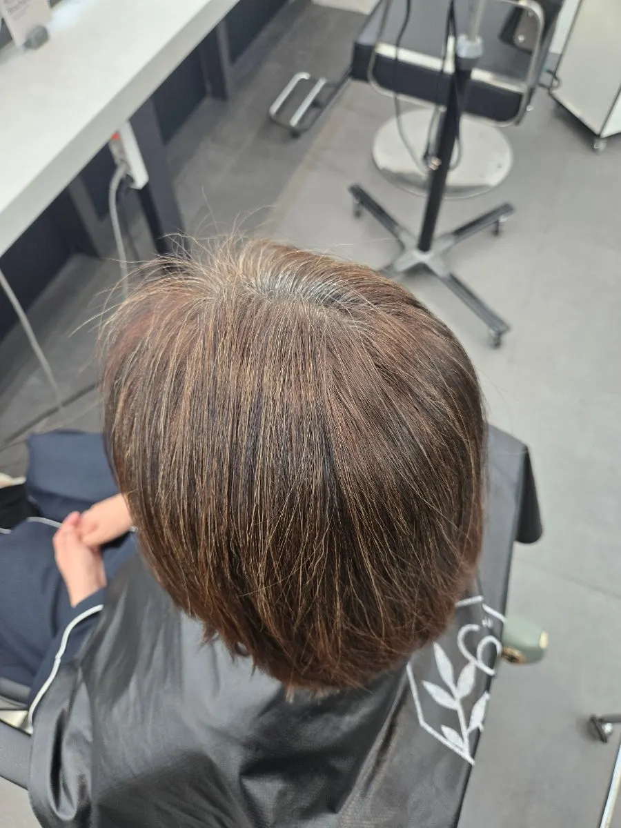 Hair condition at the crown showing gray before treatment