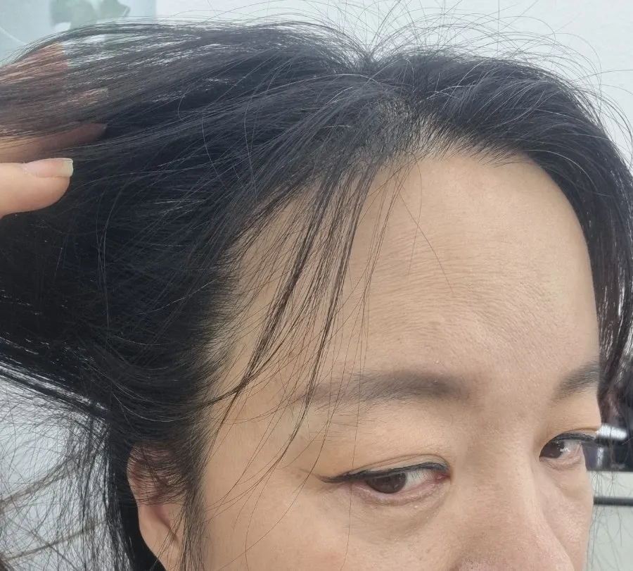 갈라지고 상한 머리끝 상태