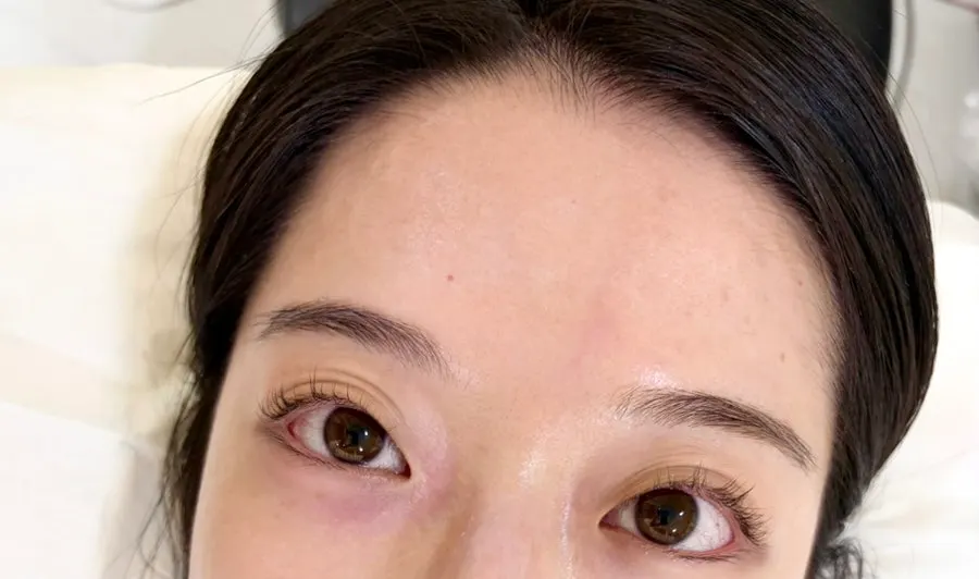 Lash lift condition after loosening over a month