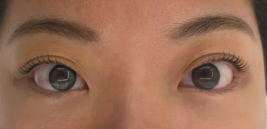 Dramatically lifted lash lift result