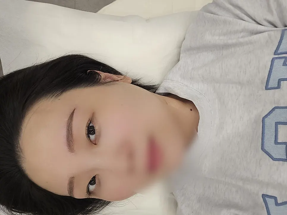 콤보눈썹 시술 직후 눈썹 모습