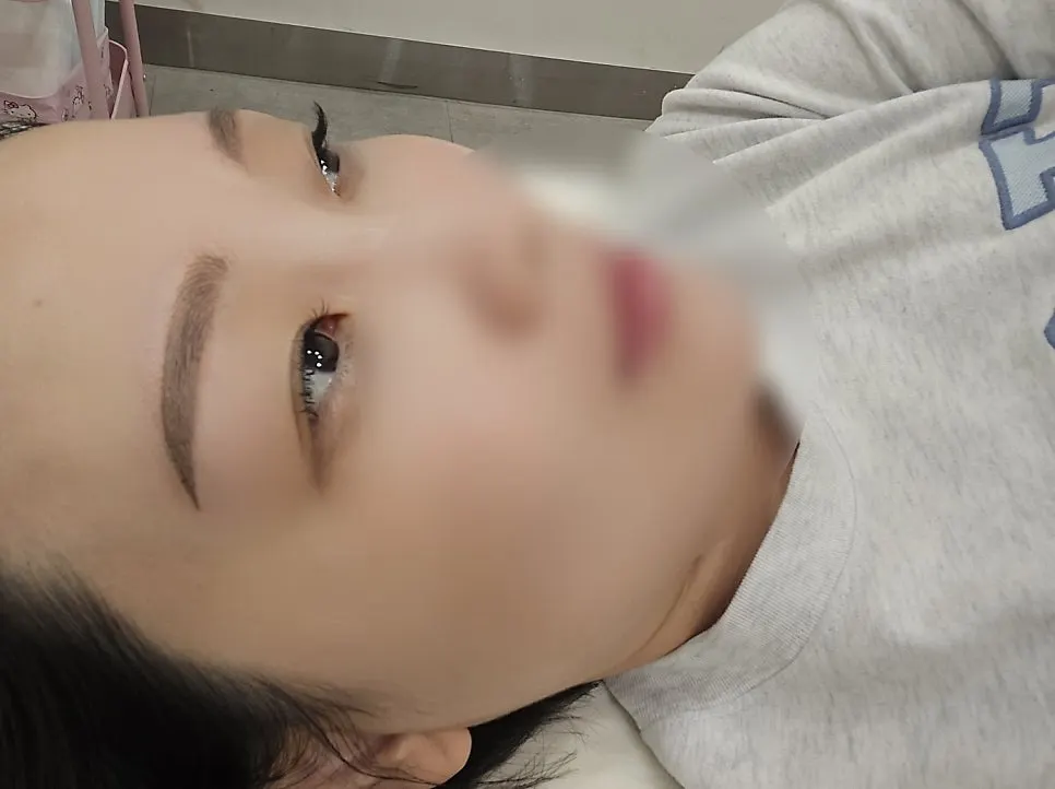 잔흔이 덮인 시술 직후 눈썹
