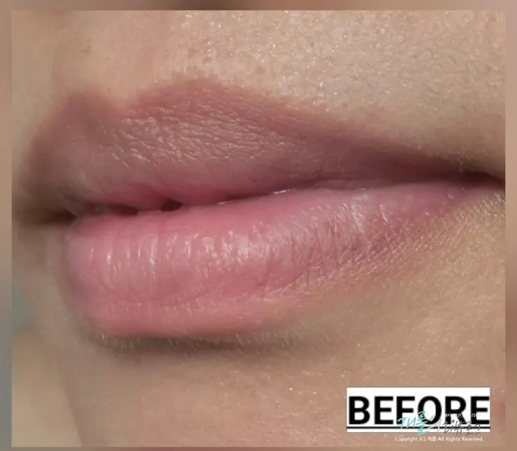 Applying the lip mask to the lips