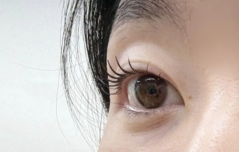 Before-and-after comparison of straight-lash lift