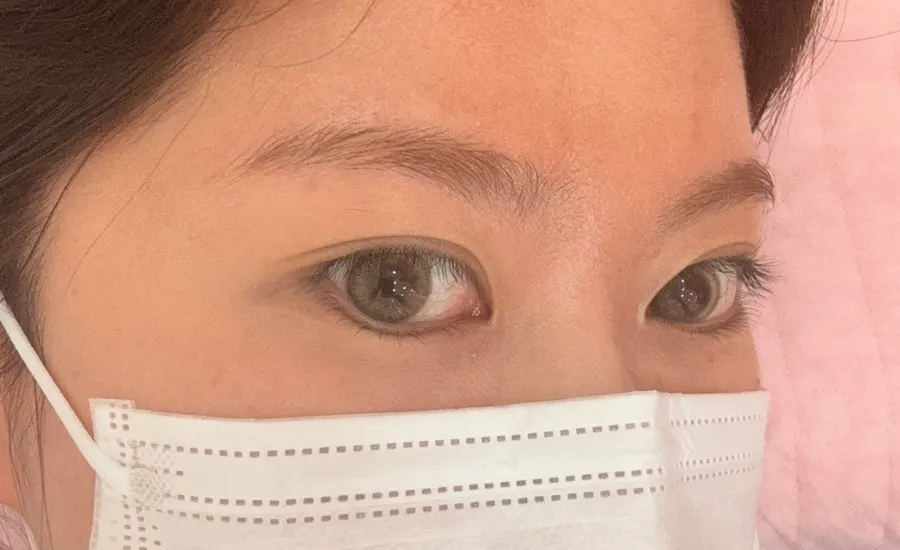 Lashes before the moisture-and-nourishment lash lift